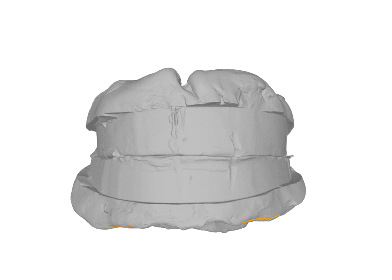 Validated SmartScan 3D scan